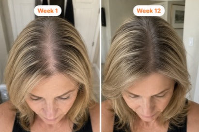 Gebruiker van het hoofdhuidserum, week 1 en week 12