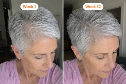 Gebruiker van het hoofdhuidserum, week 1 en week 12